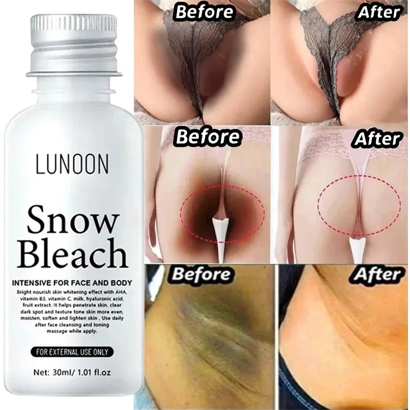 Whitening Cream Private Parts Underarm Bleaching Serum Whiten Butt Knee Brighten Inner Thigh Intimate Parts Dark Remove Melanin.Crema blanqueadora para partes privadas,