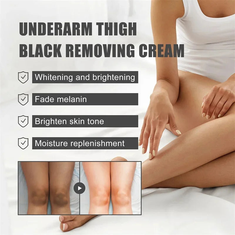 Whitening Cream Private Parts Underarm Bleaching Serum Whiten Butt Knee Brighten Inner Thigh Intimate Parts Dark Remove Melanin.Crema blanqueadora para partes privadas,