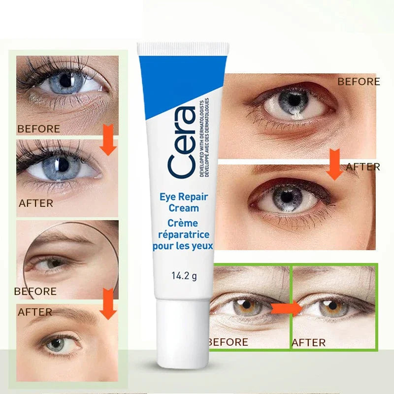 Retinol Anti-wrinkle Eye Cream Dark Circles Eye Bags Remove Anti-puffiness Fade Fine Lines Moisturizing Eye Care OriCrema antiarrugas para ojos con retinolginal.